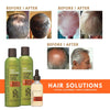 Bundle Hair Solutions - Hair Growth Energizing System | Peter Lamas